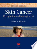 Skin cancer recognition and management /