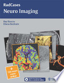 Neuro imaging