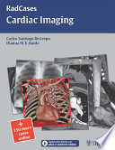 Radcases cardiac imaging