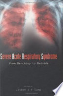 Severe acute respiratory syndrome from benchtop to bedside   /