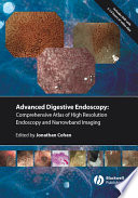 Comprehensive atlas of high resolution endoscopy and narrow band imaging