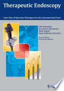 Therapeutic endoscopy color atlas of operative techniques for the gastrointestinal tract /