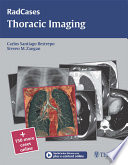 Thoracic imaging