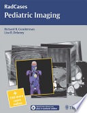 Pediatric imaging
