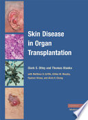 Skin disease in organ transplantation