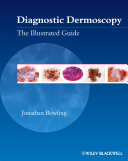 Diagnostic dermoscopy the illustrated guide /