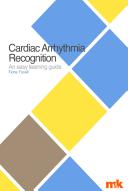 Cardiac arrhythmia recognition an easy learning guide /