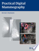 Practical digital mammography