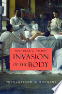 Invasion of the body revolutions in surgery /