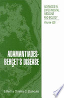 Adamantiades-Behçet's disease