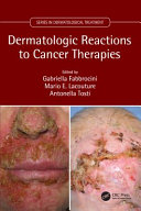 Dermatologic reactions in cancer therapies /