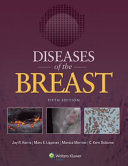 Diseases of the breast /