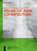 Atlas of AIDS co-infection /