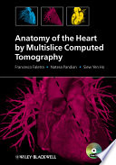 Anatomy of the heart by multislice computed tomography