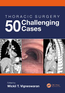 Thoracic surgery : 50 challenging cases /
