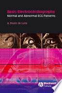 Basic electrocardiography normal and abnormal ECG patterns /