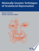 Minimally invasive techniques of oculo-facial rejuvenation