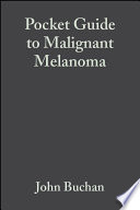 Pocket guide to malignant melanoma