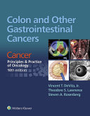 Colon and other gastrointestinal cancers : cancer : principles & practice of oncology /