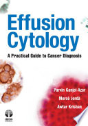 Effusion cytology a practical guide to cancer diagnosis /