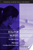 ECGs for nurses
