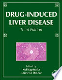 Drug-induced liver disease