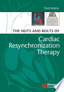 The nuts and bolts of cardiac resynchronization therapy