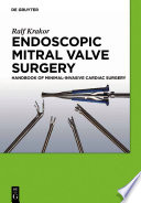 Endoscopic mitral valve surgery handbook of minimal-invasive cardiac surgery /