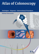 Atlas of colonoscopy examination techniques and diagnosis /