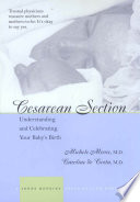 Cesarean section understanding and celebrating your baby's birth /