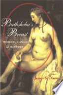 Bathsheba's breast women, cancer & history /