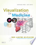Visualization in medicine theory, algorithms, and applications /