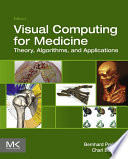 Visual computing for medicine : theory, algorithms, and applications /