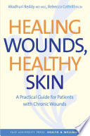 Healing wounds, healthy skin a practical guide for patients with chronic wounds /