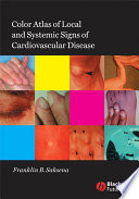 Color atlas of local and systemic signs of cardiovascular disease
