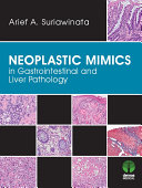 Neoplastic mimics in gastrointestinal and liver pathology /