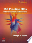 150 practice ECGs interpretation and review /