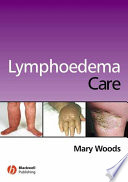 Lymphoedema care